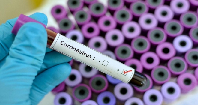 Koronavirüsten Rize'de 5. Ölüm Haberi
